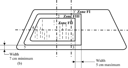 Reg43  Ann17 fig 2b