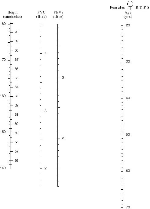 A diagram consisting of a predictive nomogram for females showing forced expiratory volume over one second, and forced vital capacity, by reference to height and age